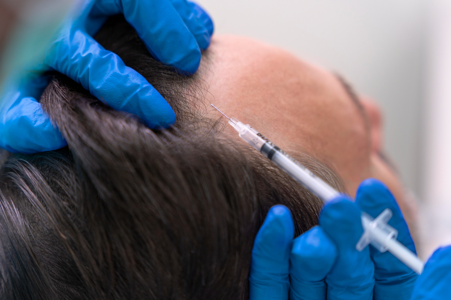 GFC Hair Therapy