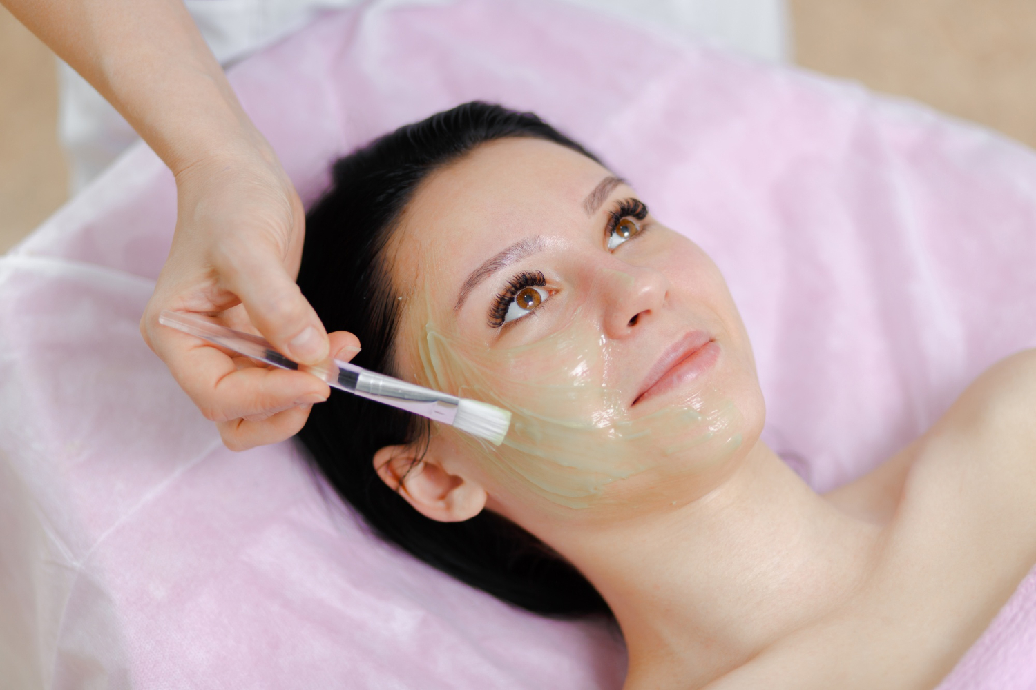 Chemical Peels